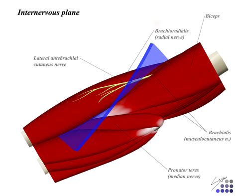 Image result for Elbow Contralateral