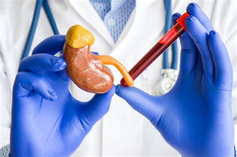 Creatinine que es | 24-7.is