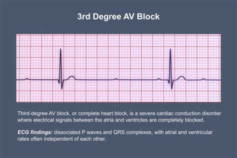 Image result for ACLS Code Blue Algorithm