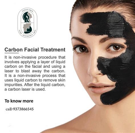 Dermapen microneedling in ottawa – Artofit
