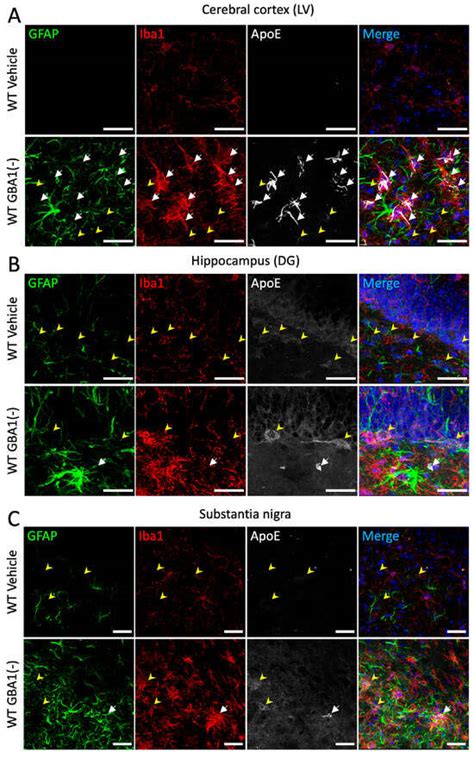 Loss of Lipid Carrier ApoE Exacerbates Brain Glial and Inflammatory ...