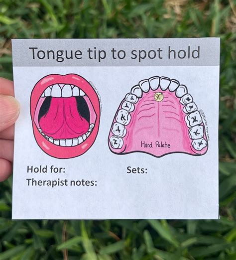 Tongue Myofunctional Therapy Exercise Cards Pdfs FREE Coloring Page ...
