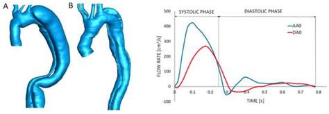Bioengineering | Special Issue : Recent Progress in Cardiovascular ...