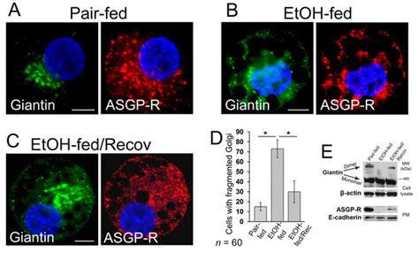 Biomolecules | Special Issue : Multi-Organ Alcohol-Related Damage ...