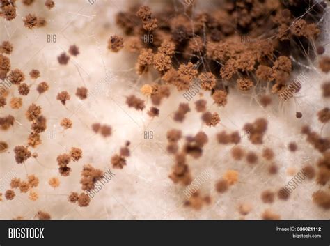 Mold Under Microscope 的图像结果