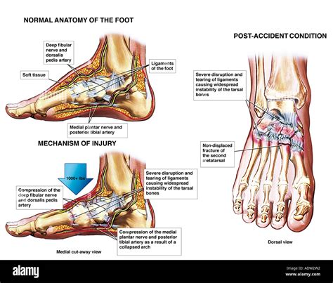 Dorsalis Pedis Pulse