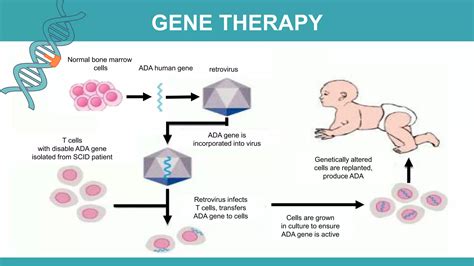 Adenosine Deaminase Deficiency | PPTX