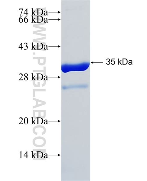 EPHB2 Fusion Protein Ag28786 | Proteintech