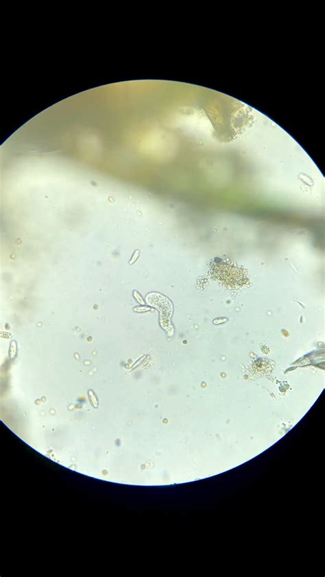 Image result for Amoeba Microscopy