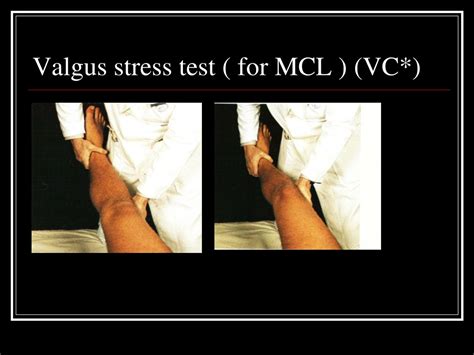 PPT - Knee Examination PowerPoint Presentation, free download - ID:231141