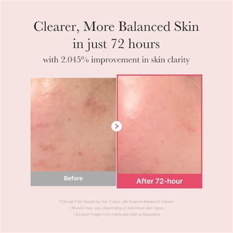 Medicube TXA Serum & TXA Cream Duo | Brightening & Dark Spot Treatment ...