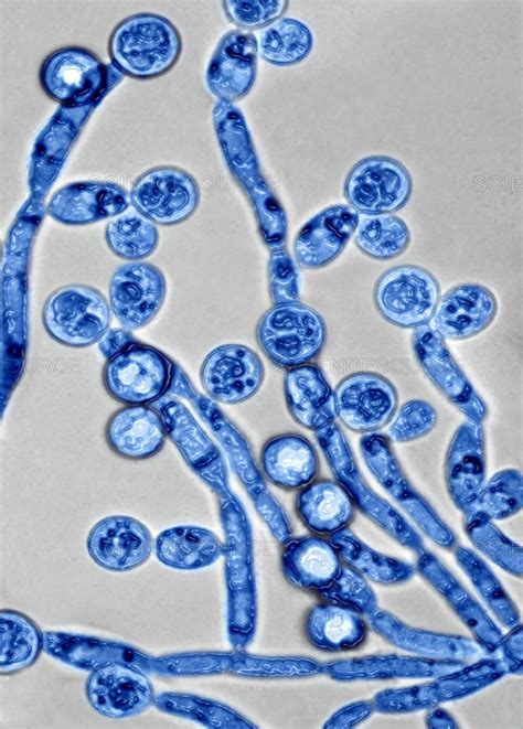 Bildergebnis für candida hiivasieni