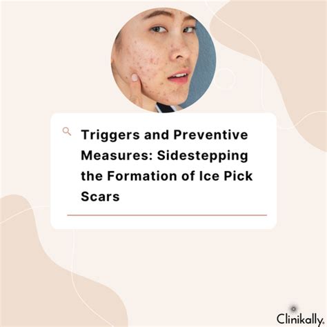 How Can You Treat Ice Pick Scars for a Smoother Complexion