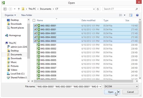 Load File DICOM Viewer 的图像结果