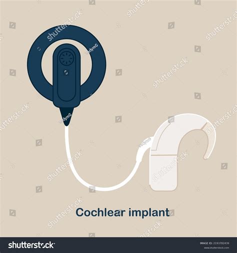 Image result for Cochlear