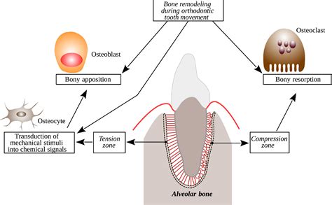 Bone remodeling during orthodontic tooth movement - Bone formation and ...