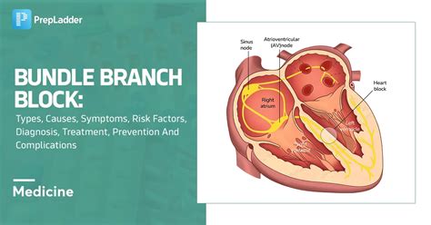 Image result for Insurance Principles Vector