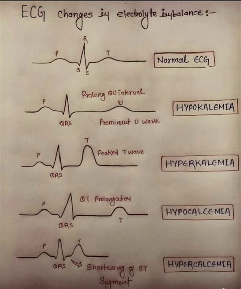 ECG ️🫀 1. Normal ECG Shows normal waveforms, including P, QRS, and T waves. 2. Prolonged Q-T ...