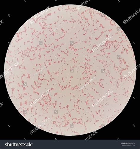 Microscope Bacteria 的图像结果
