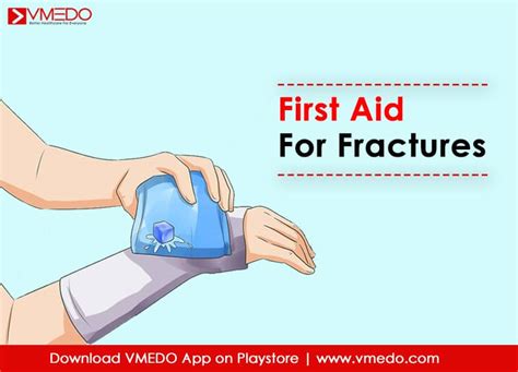 Image result for Basic Fractures First Aid