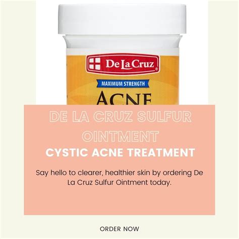 Reclaim Your Skin: De La Cruz Sulfur Ointment for Rapid Cystic Acne ...