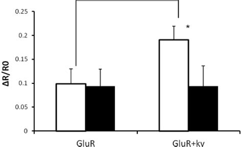 Post-Synapse Model Cell for Synaptic Glutamate Receptor (GluR)-Based ...