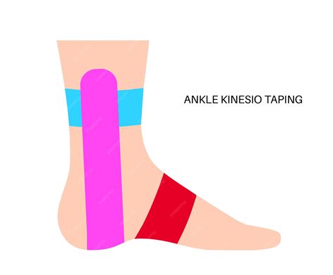 Ankle Taping Diagram