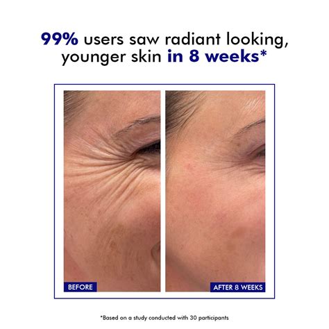 Acne Treatment Gel for Breakouts & Dark Spots – Conscious Chemist