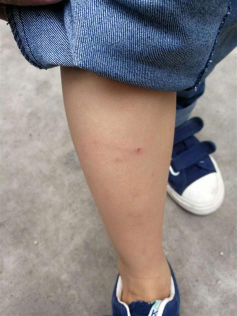深圳一男孩被街坊养的狗咬伤两次，其父将狗打死遭索赔2万_荔枝网新闻