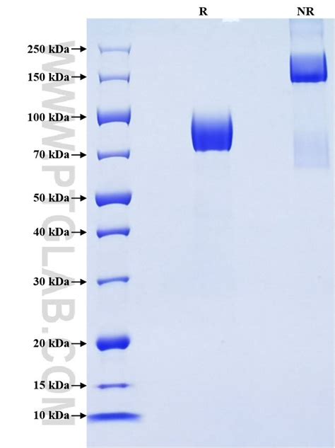 Recombinant Human Nectin 3 protein (rFc Tag) (HPLC verified) | Proteintech