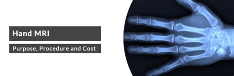 Image result for High-Resolution Hand MRI