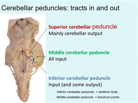 Lab Week 5: Basal Ganglia and Cerebellum – Rehab 551 Lab