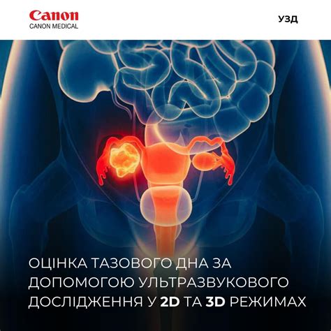 Оцінка тазового дна за допомогою ультразвуку: корисний інструмент