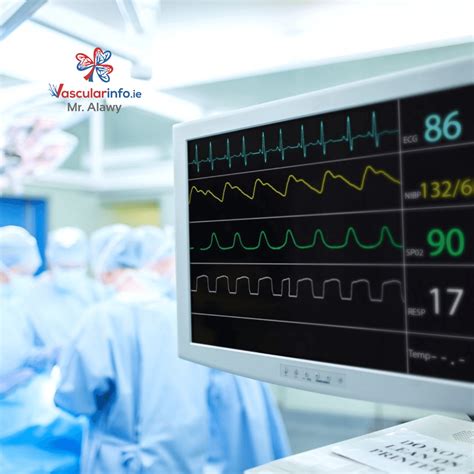 Thoracic Outlet Syndrome - Vascular Info