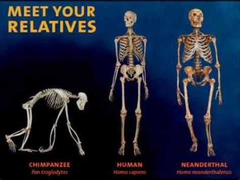 Image result for Skeleton Brain Exploding