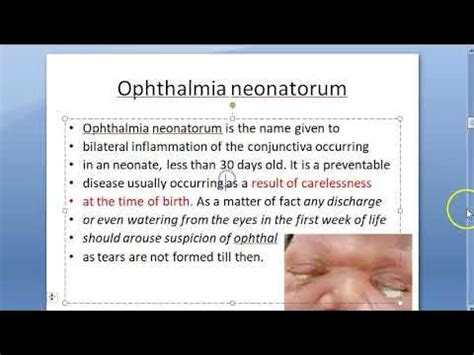 Ophthalmology Neonatal Conjunctivitis Ophthalmia Neonatorum Causes Eye ...