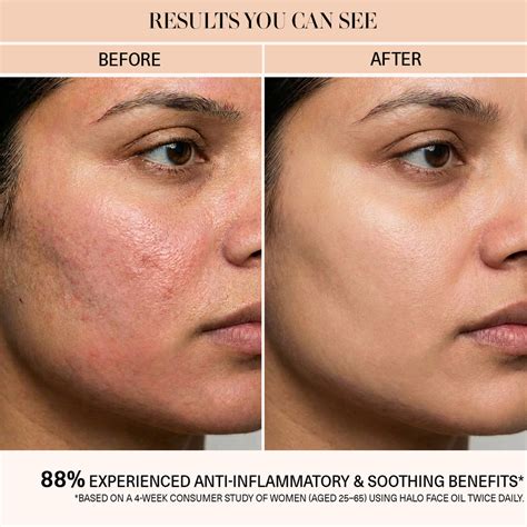 BiE Clean Beauty Trusted Skincare | Upto 15% Off - Shop Now