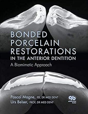 Buy Bonded Porcelain Restorations in the Anterior Dentition: A ...