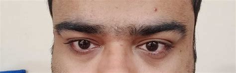 Iris scanners in the dock as IBPS candidates claim infection, no ...