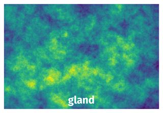 GlaS@MICCAI'2015: Gland Segmentation - Dataset Ninja