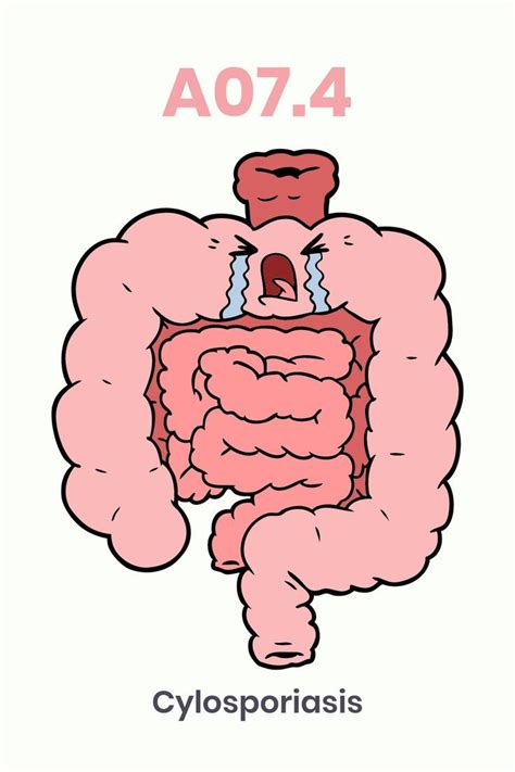 icd 10 code for fibromyalgia
