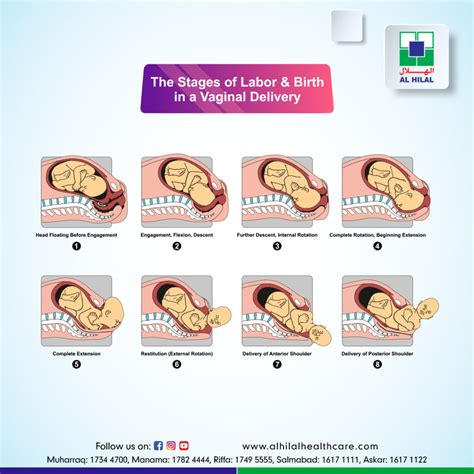 Stages Of Vaginal Delivery