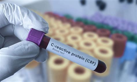 CRP point-of-care test reduces antibiotic use in patients with acute ...