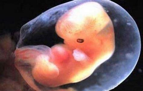 胎儿没胎心胎芽是不在了吗？孕囊、胎心、胎芽的这些秘密，要了解__凤凰网