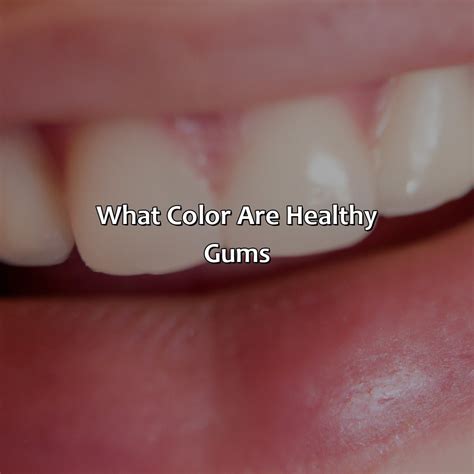 Image result for Gum Color