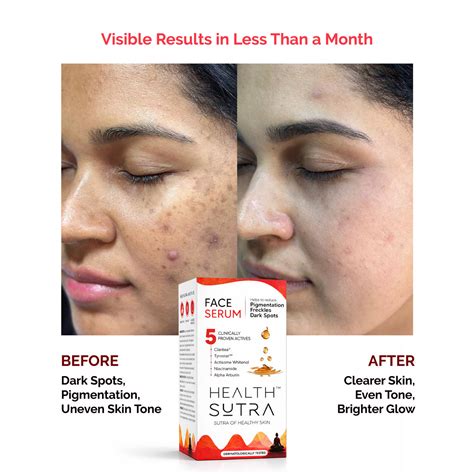 Face Serum with Claritea® for Pigmentation & Dark Spots | 30ml – Health ...