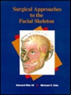 Buy Principles of Internal Fixation of the Craniomaxillofacial Skeleton ...