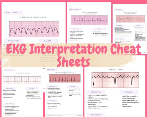 How To Read Ekg Registered Nurse Rn