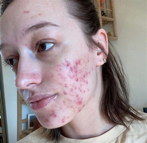 Image result for Claravis Compounding Powder