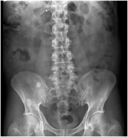 Radiografía simple de abdomen - Síntesis de Conocimientos